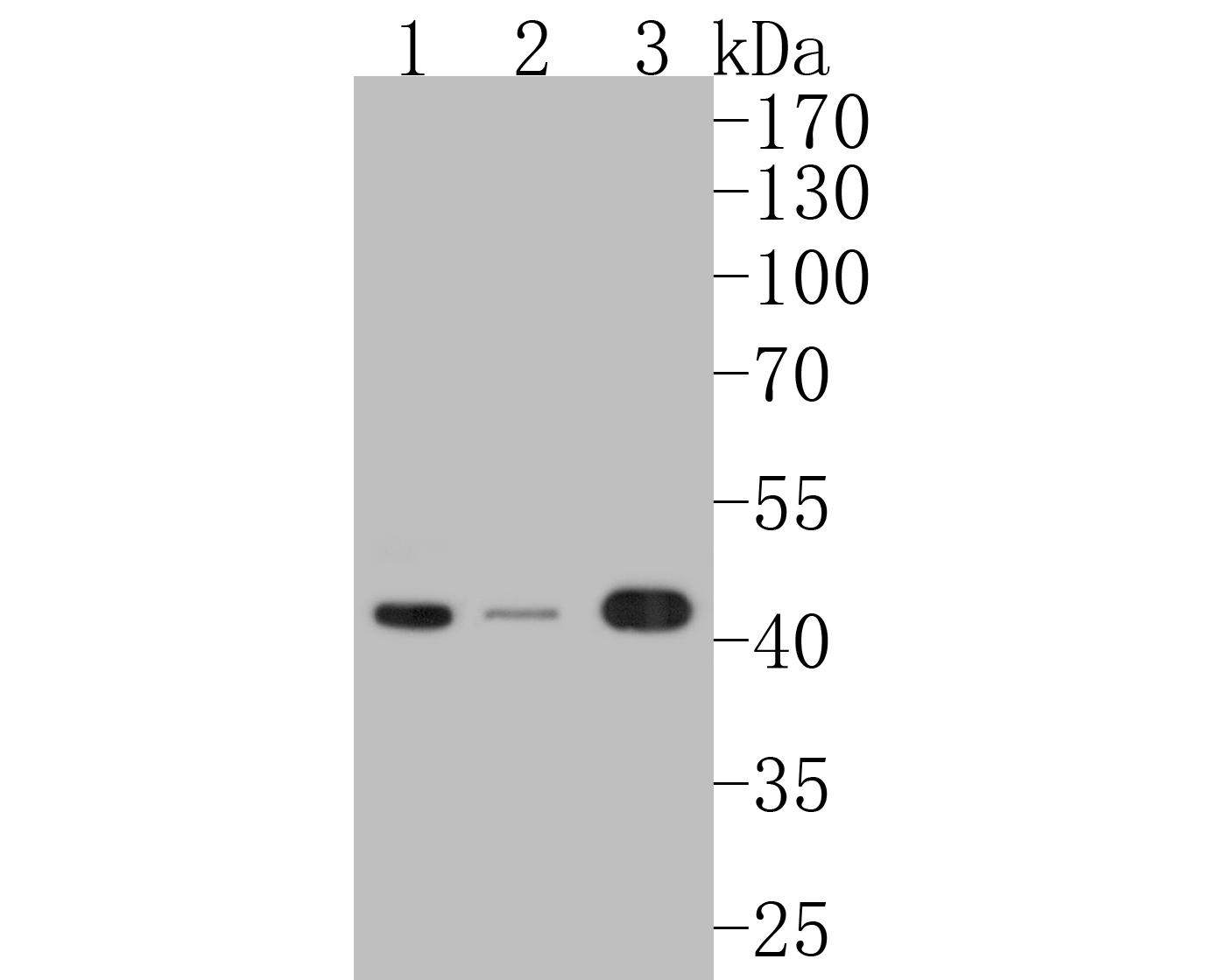 Western blot analysis of Phospho-MEK1 (S218 + S222) on different lysates. Proteins were transferred to a PVDF membrane and blocked with 5% BSA in PBS for 1 hour at room temperature. The primary antibody (ET1609-50, 1/500) was used in 5% BSA at room temperature for 2 hours. Goat Anti-Rabbit IgG - HRP Secondary Antibody (HA1001) at 1:5,000 dilution was used for 1 hour at room temperature.<br />
Positive control: <br />
Lane 1: Hela cell lysate<br />
Lane 2: A431 cell lysate<br />
Lane 2: 293T cell lysate