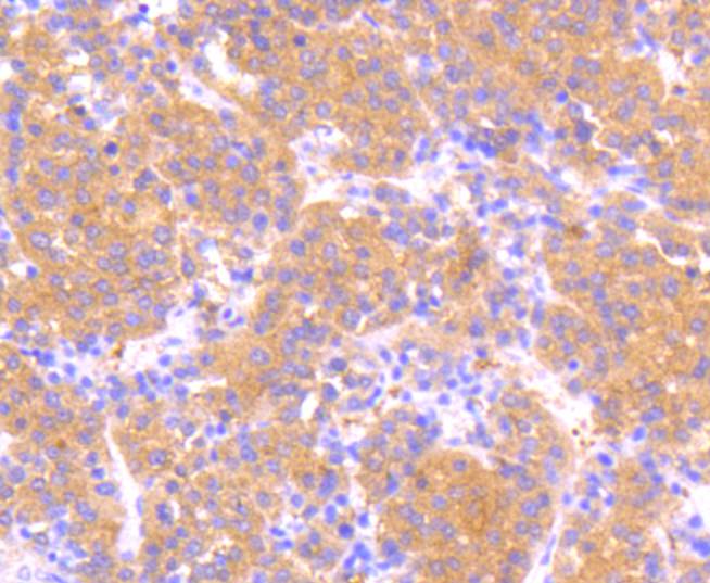 Immunohistochemical analysis of paraffin-embedded human spleen tissue using anti-Phospho-MEK1(S218/S222) antibody. The section was pre-treated using heat mediated antigen retrieval with Tris-EDTA buffer (pH 8.0-8.4) for 20 minutes.The tissues were blocked in 5% BSA for 30 minutes at room temperature, washed with ddH2O and PBS, and then probed with the primary antibody (ET1609-50, 1/50) for 30 minutes at room temperature. The detection was performed using an HRP conjugated compact polymer system. DAB was used as the chromogen. Tissues were counterstained with hematoxylin and mounted with DPX.