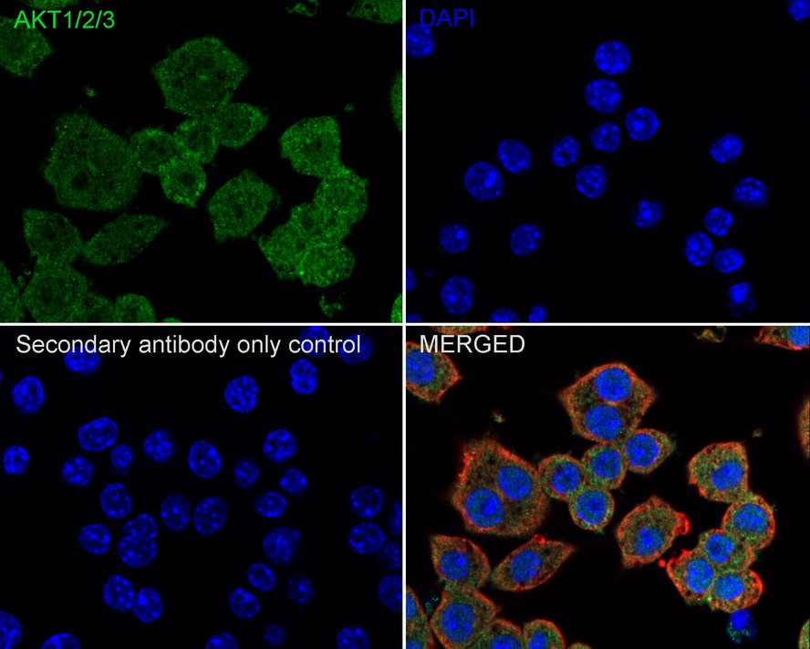 ICC staining of AKT1/2/3 in A549 cells (green). Formalin fixed cells were permeabilized with 0.1% Triton X-100 in TBS for 10 minutes at room temperature and blocked with 1% Blocker BSA for 15 minutes at room temperature. Cells were probed with the primary antibody (ET1609-51, 1/50) for 1 hour at room temperature, washed with PBS. Alexa Fluor®488 Goat anti-Rabbit IgG was used as the secondary antibody at 1/1,000 dilution. The nuclear counter stain is DAPI (blue).