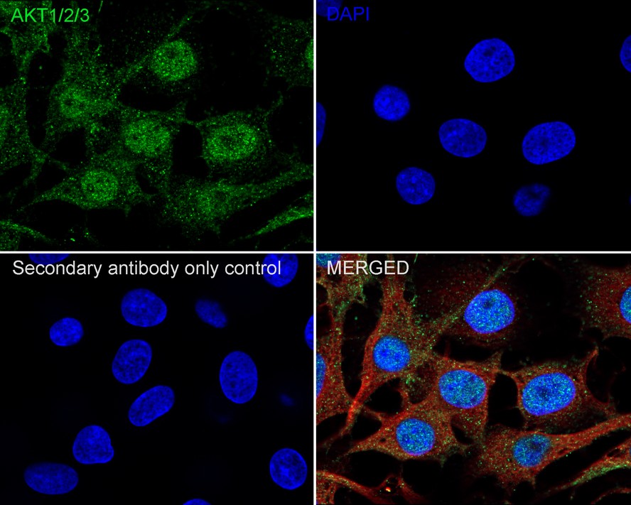 ICC staining of AKT1/2/3 in CRC cells (green). Formalin fixed cells were permeabilized with 0.1% Triton X-100 in TBS for 10 minutes at room temperature and blocked with 1% Blocker BSA for 15 minutes at room temperature. Cells were probed with the primary antibody (ET1609-51, 1/50) for 1 hour at room temperature, washed with PBS. Alexa Fluor®488 Goat anti-Rabbit IgG was used as the secondary antibody at 1/1,000 dilution. The nuclear counter stain is DAPI (blue).