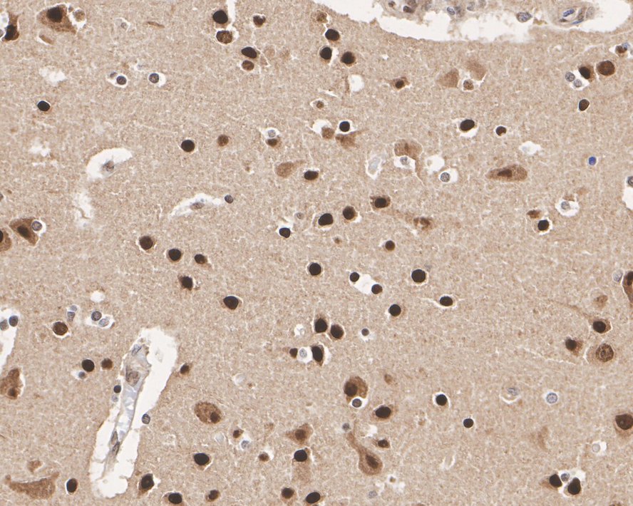 Immunohistochemical analysis of paraffin-embedded human kidney tissue using anti-AKT1/2/3 antibody. The section was pre-treated using heat mediated antigen retrieval with Tris-EDTA buffer (pH 8.0-8.4) for 20 minutes.The tissues were blocked in 5% BSA for 30 minutes at room temperature, washed with ddH2O and PBS, and then probed with the primary antibody (ET1609-51, 1/50) for 30 minutes at room temperature. The detection was performed using an HRP conjugated compact polymer system. DAB was used as the chromogen. Tissues were counterstained with hematoxylin and mounted with DPX.