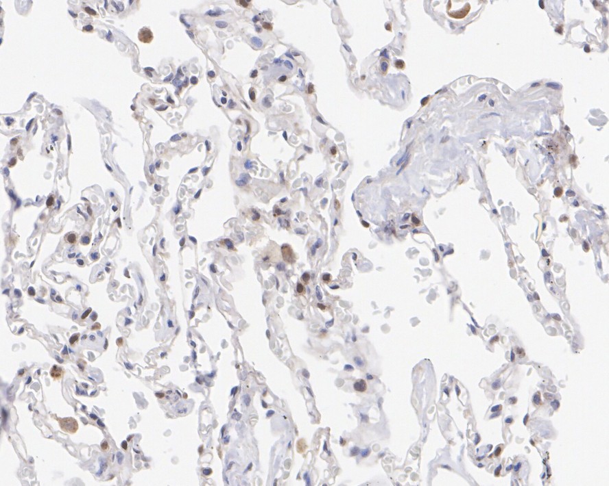 Immunohistochemical analysis of paraffin-embedded mouse brain tissue using anti-AKT1/2/3 antibody. The section was pre-treated using heat mediated antigen retrieval with Tris-EDTA buffer (pH 8.0-8.4) for 20 minutes.The tissues were blocked in 5% BSA for 30 minutes at room temperature, washed with ddH2O and PBS, and then probed with the primary antibody (ET1609-51, 1/50) for 30 minutes at room temperature. The detection was performed using an HRP conjugated compact polymer system. DAB was used as the chromogen. Tissues were counterstained with hematoxylin and mounted with DPX.