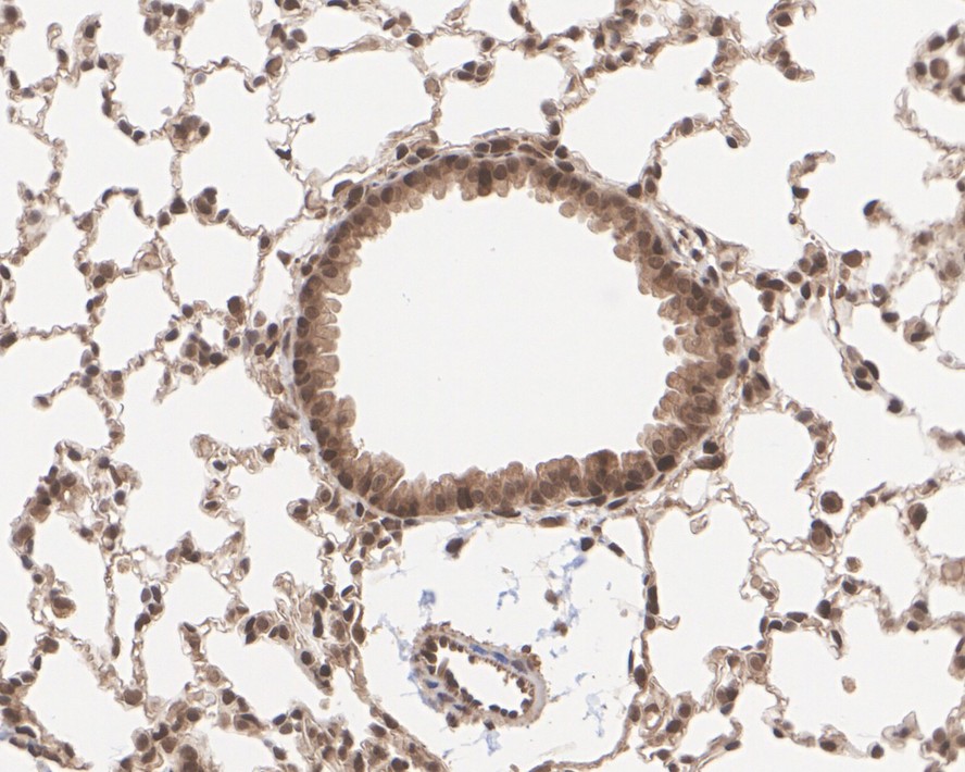 Immunohistochemical analysis of paraffin-embedded mouse heart tissue using anti-AKT1/2/3 antibody. The section was pre-treated using heat mediated antigen retrieval with Tris-EDTA buffer (pH 8.0-8.4) for 20 minutes.The tissues were blocked in 5% BSA for 30 minutes at room temperature, washed with ddH2O and PBS, and then probed with the primary antibody (ET1609-51, 1/50) for 30 minutes at room temperature. The detection was performed using an HRP conjugated compact polymer system. DAB was used as the chromogen. Tissues were counterstained with hematoxylin and mounted with DPX.