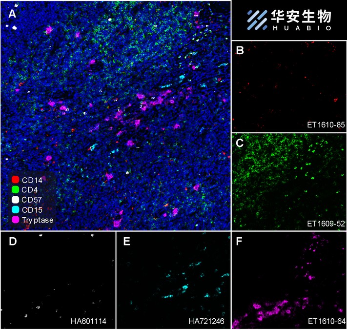 Immunohistochemical analysis of paraffin-embedded human spleen tissue with Rabbit anti-CD4 antibody (ET1609-52) at 1/400 dilution.<br />
<br />
The section was pre-treated using heat mediated antigen retrieval with Tris-EDTA buffer (pH 9.0) for 20 minutes. The tissues were blocked in 1% BSA for 20 minutes at room temperature, washed with ddH2O and PBS, and then probed with the primary antibody (ET1609-52) at 1/400 dilution for 1 hour at room temperature. The detection was performed using an HRP conjugated compact polymer system. DAB was used as the chromogen. Tissues were counterstained with hematoxylin and mounted with DPX.