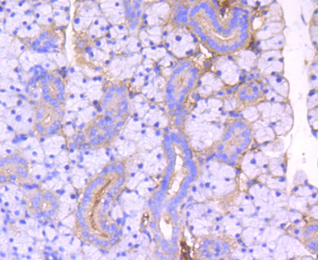 Immunohistochemical analysis of paraffin-embedded mouse thyroid tissue using anti-ROCK1 antibody. The section was pre-treated using heat mediated antigen retrieval with Tris-EDTA buffer (pH 8.0-8.4) for 20 minutes.The tissues were blocked in 5% BSA for 30 minutes at room temperature, washed with ddH2O and PBS, and then probed with the primary antibody (ET1609-53, 1/50) for 30 minutes at room temperature. The detection was performed using an HRP conjugated compact polymer system. DAB was used as the chromogen. Tissues were counterstained with hematoxylin and mounted with DPX.