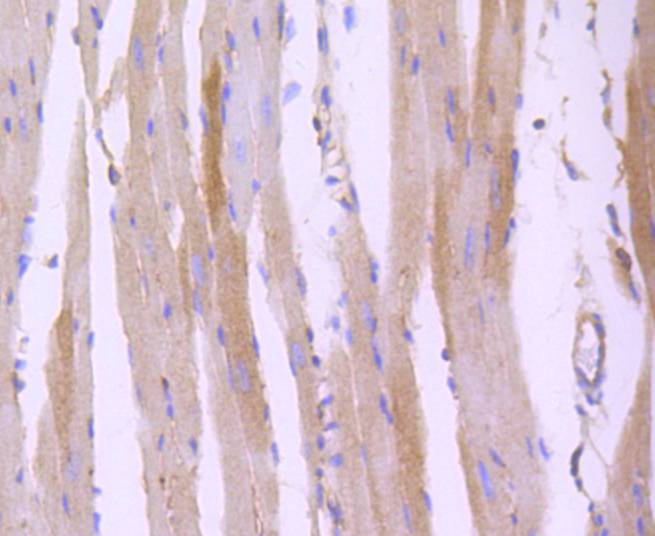 Immunohistochemical analysis of paraffin-embedded mouse heart tissue using anti-ROCK1 antibody. The section was pre-treated using heat mediated antigen retrieval with Tris-EDTA buffer (pH 8.0-8.4) for 20 minutes.The tissues were blocked in 5% BSA for 30 minutes at room temperature, washed with ddH2O and PBS, and then probed with the primary antibody (ET1609-53, 1/50) for 30 minutes at room temperature. The detection was performed using an HRP conjugated compact polymer system. DAB was used as the chromogen. Tissues were counterstained with hematoxylin and mounted with DPX.