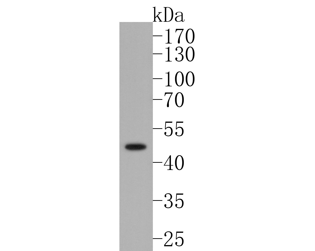 Western blot analysis of Cytokeratin 15 on A431 cell lysates. Proteins were transferred to a PVDF membrane and blocked with 5% BSA in PBS for 1 hour at room temperature. The primary antibody (ET1609-54, 1/500) was used in 5% BSA at room temperature for 2 hours. Goat Anti-Rabbit IgG - HRP Secondary Antibody (HA1001) at 1:5,000 dilution was used for 1 hour at room temperature.