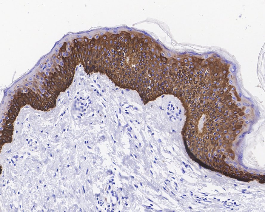 Immunohistochemical analysis of paraffin-embedded human skin tissue with Rabbit anti-Cytokeratin 15 antibody (ET1609-54) at 1/1,500 dilution.<br />
<br />
The section was pre-treated using heat mediated antigen retrieval with Tris-EDTA buffer (pH 9.0) for 20 minutes. The tissues were blocked in 1% BSA for 20 minutes at room temperature, washed with ddH2O and PBS, and then probed with the primary antibody (ET1609-54) at 1/1,500 dilution for 1 hour at room temperature. The detection was performed using an HRP conjugated compact polymer system. DAB was used as the chromogen. Tissues were counterstained with hematoxylin and mounted with DPX.