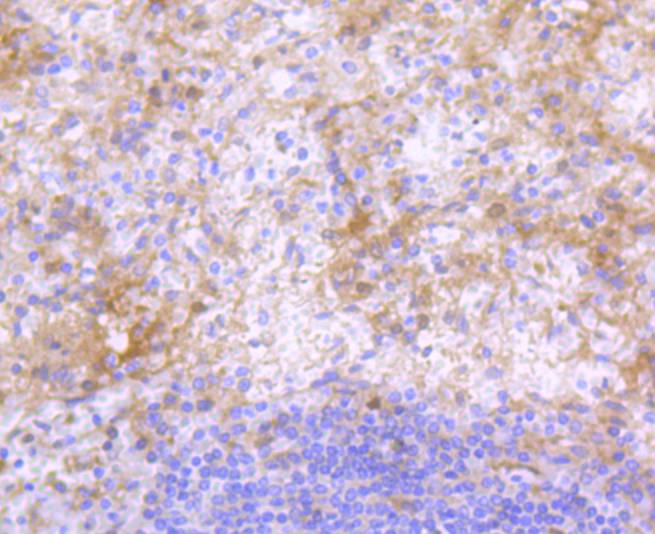 Immunohistochemical analysis of paraffin-embedded human spleen tissue using anti-IgG4 antibody. The section was pre-treated using heat mediated antigen retrieval with Tris-EDTA buffer (pH 8.0-8.4) for 20 minutes.The tissues were blocked in 5% BSA for 30 minutes at room temperature, washed with ddH2O and PBS, and then probed with the primary antibody (ET1609-56, 1/50) for 30 minutes at room temperature. The detection was performed using an HRP conjugated compact polymer system. DAB was used as the chromogen. Tissues were counterstained with hematoxylin and mounted with DPX.