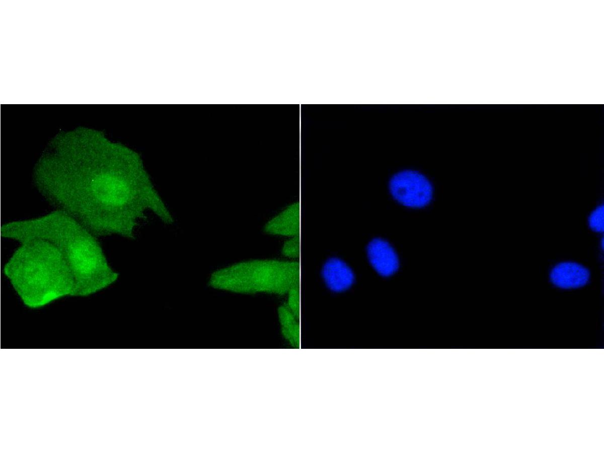 ICC staining of Histone H3.3 in BT-20 cells (green). Formalin fixed cells were permeabilized with 0.1% Triton X-100 in TBS for 10 minutes at room temperature and blocked with 1% Blocker BSA for 15 minutes at room temperature. Cells were probed with the primary antibody (ET1609-59, 1/50) for 1 hour at room temperature, washed with PBS. Alexa Fluor®488 Goat anti-Rabbit IgG was used as the secondary antibody at 1/1,000 dilution. The nuclear counter stain is DAPI (blue).