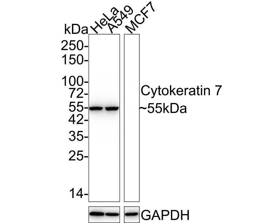 Western blot analysis of Cytokeratin 7 on different lysates with Rabbit anti-Cytokeratin 7 antibody (ET1609-62) at 1/5,000 dilution.<br />
<br />
Lane 1: HeLa cell lysate<br />
Lane 2: A549 cell lysate<br />
Lane 3: MCF7 cell lysate (negative)<br />
<br />
Lysates/proteins at 15 µg/Lane.<br />
<br />
Predicted band size: 51 kDa<br />
Observed band size: 55 kDa<br />
<br />
Exposure time: 20 seconds;<br />
<br />
4-20% SDS-PAGE gel.<br />
<br />
Proteins were transferred to a PVDF membrane and blocked with 5% NFDM/TBST for 1 hour at room temperature. The primary antibody (ET1609-62) at 1/5,000 dilution was used in 5% NFDM/TBST at 4℃ overnight. Goat Anti-Rabbit IgG - HRP Secondary Antibody (HA1001) at 1/50,000 dilution was used for 1 hour at room temperature.