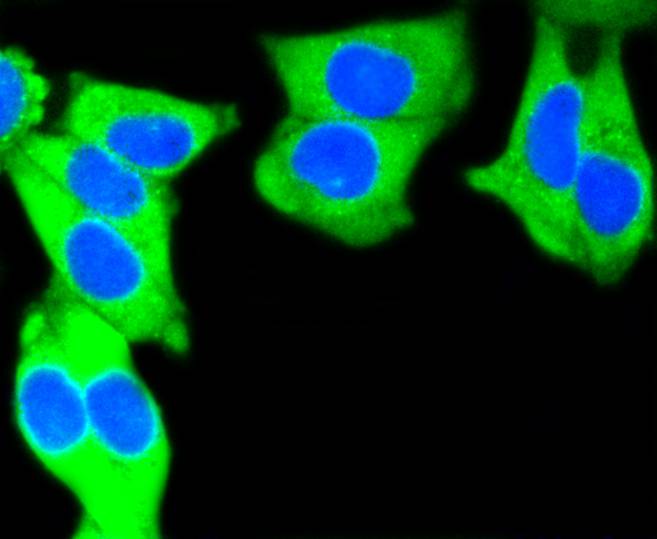 Immunocytochemistry staining of Cytokeratin 7 in Hela cells (green). Formalin fixed cells were permeabilized with 0.1% Triton X-100 in TBS for 10 minutes at room temperature and blocked with 1% Blocker BSA for 15 minutes at room temperature. Cells were probed with the primary antibody (ET1609-62, 1/50) for 1 hour at room temperature, washed with PBS. Alexa Fluor®488 Goat anti-Rabbit IgG was used as the secondary antibody at 1/1,000 dilution. The nuclear counter stain is DAPI (blue).