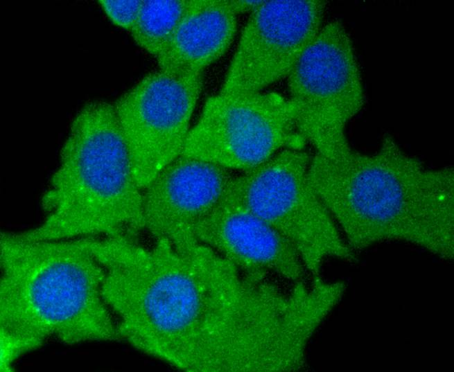 Immunocytochemistry staining of Cytokeratin 7 in A549 cells (green). Formalin fixed cells were permeabilized with 0.1% Triton X-100 in TBS for 10 minutes at room temperature and blocked with 1% Blocker BSA for 15 minutes at room temperature. Cells were probed with the primary antibody (ET1609-62, 1/50) for 1 hour at room temperature, washed with PBS. Alexa Fluor®488 Goat anti-Rabbit IgG was used as the secondary antibody at 1/1,000 dilution. The nuclear counter stain is DAPI (blue).