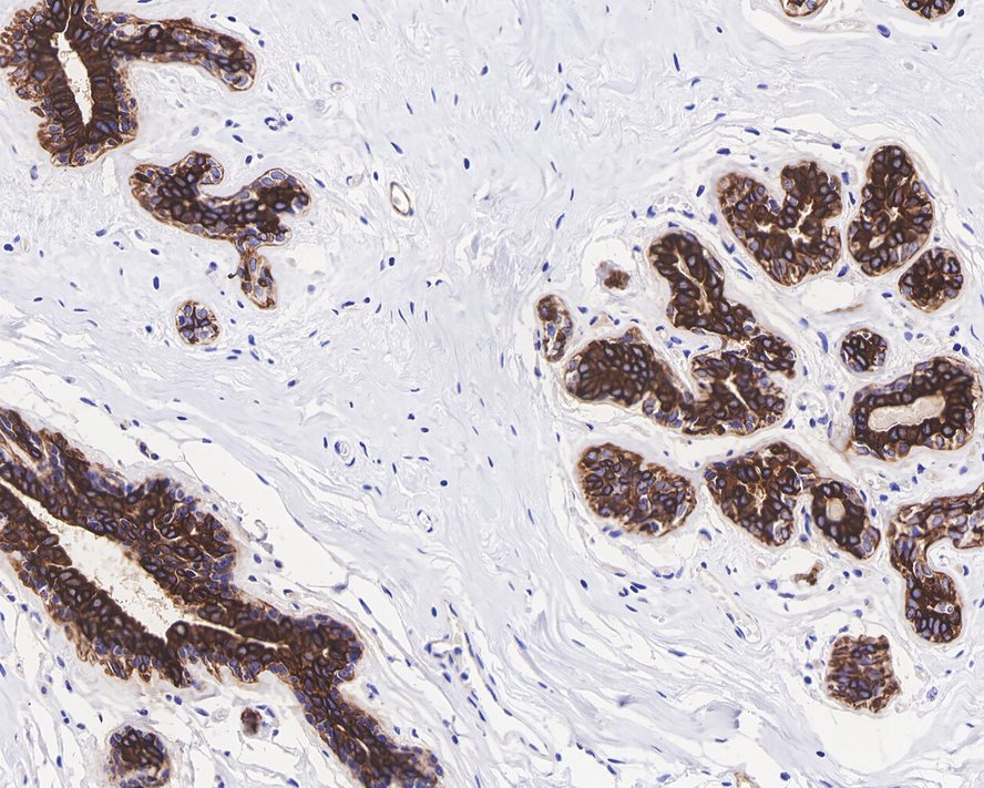 Immunocytochemistry staining of Cytokeratin 7 in BT-20 cells (green). Formalin fixed cells were permeabilized with 0.1% Triton X-100 in TBS for 10 minutes at room temperature and blocked with 1% Blocker BSA for 15 minutes at room temperature. Cells were probed with the primary antibody (ET1609-62, 1/50) for 1 hour at room temperature, washed with PBS. Alexa Fluor®488 Goat anti-Rabbit IgG was used as the secondary antibody at 1/1,000 dilution. The nuclear counter stain is DAPI (blue).