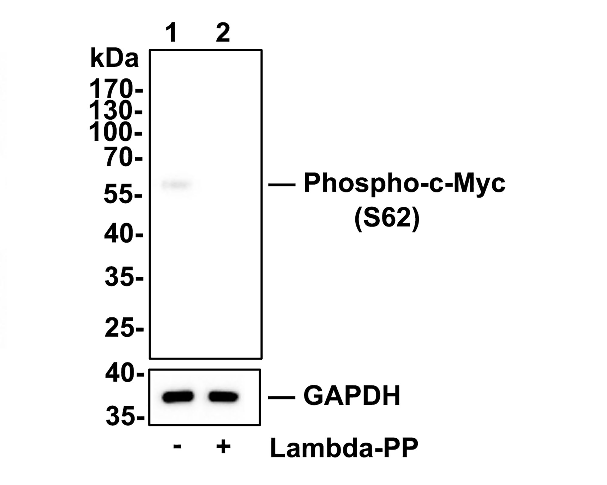 Western blot analysis of Phospho-c-Myc(S62) on HepG2 cell lysates.<br />
<br />
Lane 1: HepG2 cells, whole cell lysate, 10ug/lane<br />
Lane 2: HepG2 cells treated with 2.8ug/ul lambda-PP for 30 minutes, whole cell lysates, 10ug/lane<br />
<br />
All lanes :<br />
Anti-Phospho-c-Myc(S62) antibody (ET1609-64) at 1:500 dilution. Anti-GAPDH antibody (ET1601-4) at 1:10,000 dilution. Goat Anti-Rabbit IgG H&L (HRP) (HA1001) at 1/200,000 dilution.<br />
<br />
Predicted band size: 49 kDa<br />
Observed band size: 57 kDa<br />
<br />
Blocking and diluting buffer: 5% BSA.<br />
<br />
Exposure time: 3 minutes