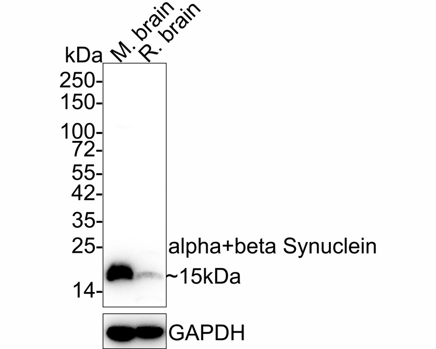 Western blot analysis of alpha+beta Synuclein on rat brain tissue lysates. Proteins were transferred to a PVDF membrane and blocked with 5% BSA in PBS for 1 hour at room temperature. The primary antibody (ET1609-66, 1/500) was used in 5% BSA at room temperature for 2 hours. Goat Anti-Rabbit IgG - HRP Secondary Antibody (HA1001) at 1:5,000 dilution was used for 1 hour at room temperature.
