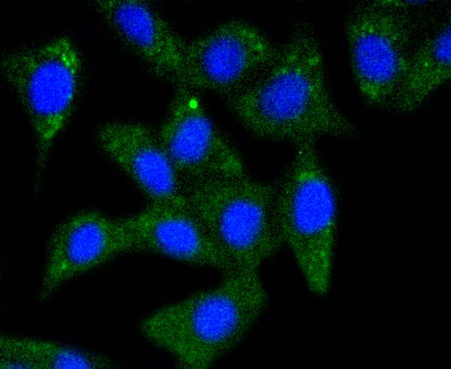 ICC staining of alpha+beta Synuclein in N2A cells (green). Formalin fixed cells were permeabilized with 0.1% Triton X-100 in TBS for 10 minutes at room temperature and blocked with 1% Blocker BSA for 15 minutes at room temperature. Cells were probed with the primary antibody (ET1609-66, 1/50) for 1 hour at room temperature, washed with PBS. Alexa Fluor®488 Goat anti-Rabbit IgG was used as the secondary antibody at 1/1,000 dilution. The nuclear counter stain is DAPI (blue).