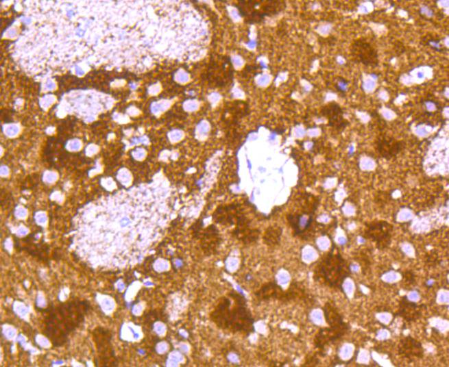 ICC staining of alpha+beta Synuclein in SH-SY5Y cells (green). Formalin fixed cells were permeabilized with 0.1% Triton X-100 in TBS for 10 minutes at room temperature and blocked with 1% Blocker BSA for 15 minutes at room temperature. Cells were probed with the primary antibody (ET1609-66, 1/50) for 1 hour at room temperature, washed with PBS. Alexa Fluor®488 Goat anti-Rabbit IgG was used as the secondary antibody at 1/1,000 dilution. The nuclear counter stain is DAPI (blue).