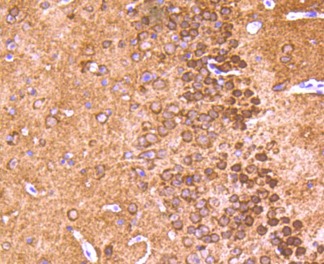 Immunohistochemical analysis of paraffin-embedded rat brain tissue using anti-alpha+beta Synuclein antibody. The section was pre-treated using heat mediated antigen retrieval with Tris-EDTA buffer (pH 8.0-8.4) for 20 minutes.The tissues were blocked in 5% BSA for 30 minutes at room temperature, washed with ddH2O and PBS, and then probed with the primary antibody (ET1609-66, 1/50) for 30 minutes at room temperature. The detection was performed using an HRP conjugated compact polymer system. DAB was used as the chromogen. Tissues were counterstained with hematoxylin and mounted with DPX.
