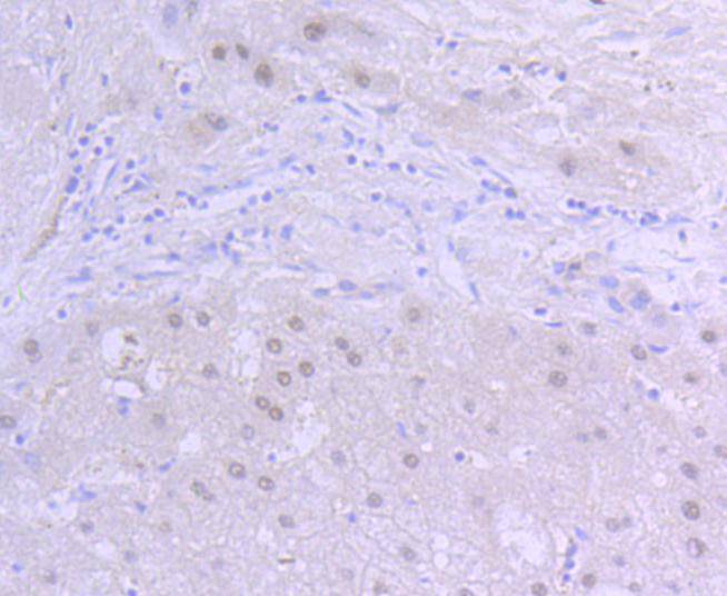Immunohistochemical analysis of paraffin-embedded human liver tissue using anti-HIF-1 beta antibody. The section was pre-treated using heat mediated antigen retrieval with Tris-EDTA buffer (pH 8.0-8.4) for 20 minutes.The tissues were blocked in 5% BSA for 30 minutes at room temperature, washed with ddH2O and PBS, and then probed with the primary antibody (ET1609-67, 1/50) for 30 minutes at room temperature. The detection was performed using an HRP conjugated compact polymer system. DAB was used as the chromogen. Tissues were counterstained with hematoxylin and mounted with DPX.