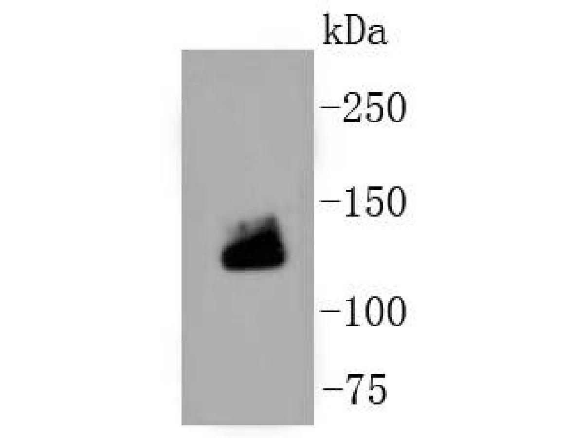Western blot analysis of COL1A1/Collagen Ⅰ on human placenta tissue lysates. Proteins were transferred to a PVDF membrane and blocked with 5% BSA in PBS for 1 hour at room temperature. The primary antibody (ET1609-68, 1/500) was used in 5% BSA at room temperature for 2 hours. Goat Anti-Rabbit IgG - HRP Secondary Antibody (HA1001) at 1:5,000 dilution was used for 1 hour at room temperature.