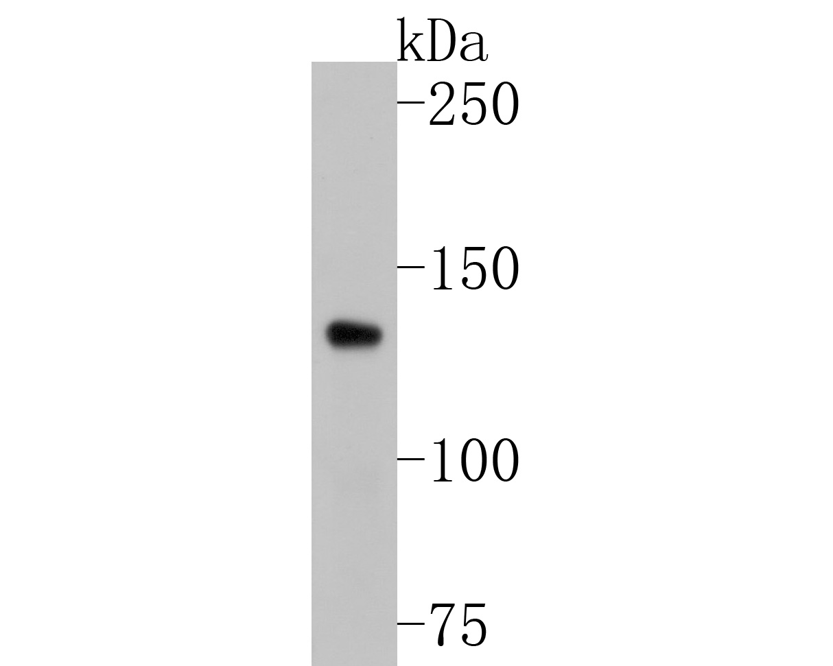 Western blot analysis of COL1A1 on human skin tissue lysates. Proteins were transferred to a PVDF membrane and blocked with 5% BSA in PBS for 1 hour at room temperature. The primary antibody (ET1609-68, 1/500) was used in 5% BSA at room temperature for 2 hours. Goat Anti-Rabbit IgG - HRP Secondary Antibody (HA1001) at 1:200,000 dilution was used for 1 hour at room temperature.