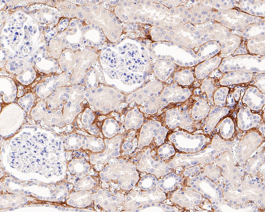 Immunohistochemical analysis of paraffin-embedded human kidney tissue with Rabbit anti-COL1A1 antibody (ET1609-68) at 1/1,000 dilution.<br />
<br />
The section was pre-treated using heat mediated antigen retrieval with sodium citrate buffer (pH 6.0) for 2 minutes. The tissues were blocked in 1% BSA for 20 minutes at room temperature, washed with ddH2O and PBS, and then probed with the primary antibody (ET1609-68) at 1/1,000 dilution for 1 hour at room temperature. The detection was performed using an HRP conjugated compact polymer system. DAB was used as the chromogen. Tissues were counterstained with hematoxylin and mounted with DPX.