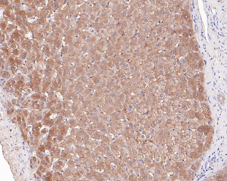 ICC staining of Neuropilin-1 in SHG-44 cells (green). Formalin fixed cells were permeabilized with 0.1% Triton X-100 in TBS for 10 minutes at room temperature and blocked with 1% Blocker BSA for 15 minutes at room temperature. Cells were probed with the primary antibody (ET1609-69, 1/50) for 1 hour at room temperature, washed with PBS. Alexa Fluor®488 Goat anti-Rabbit IgG was used as the secondary antibody at 1/1,000 dilution. The nuclear counter stain is DAPI (blue).