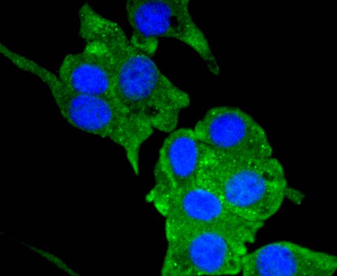 ICC staining of Neuropilin-1 in HUVEC cells (green). Formalin fixed cells were permeabilized with 0.1% Triton X-100 in TBS for 10 minutes at room temperature and blocked with 1% Blocker BSA for 15 minutes at room temperature. Cells were probed with the primary antibody (ET1609-69, 1/50) for 1 hour at room temperature, washed with PBS. Alexa Fluor®488 Goat anti-Rabbit IgG was used as the secondary antibody at 1/1,000 dilution. The nuclear counter stain is DAPI (blue).