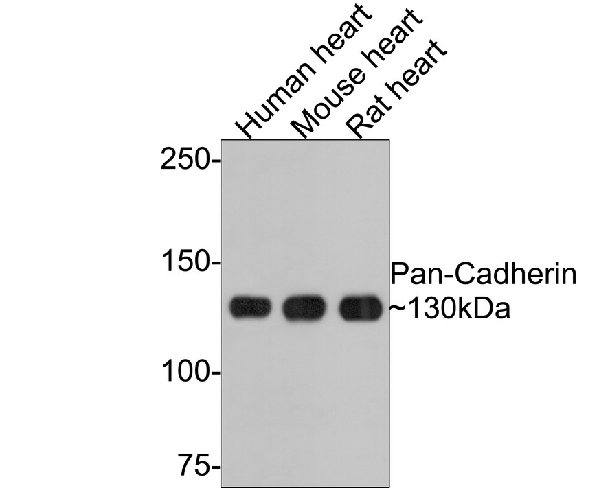 Western blot analysis of Pan-Cadherin on different lysates with Rabbit anti-Pan-Cadherin antibody (ET1609-70) at 1/1,000 dilution.<br />
<br />
Lane 1: Human heart tissue lysate<br />
Lane 2: Mouse heart tissue lysate<br />
Lane 3: Rat heart tissue lysate<br />
<br />
Lysates/proteins at 20 µg/Lane.<br />
<br />
Predicted band size: 100 kDa<br />
Observed band size: 130 kDa<br />
<br />
Exposure time: 1 minute;<br />
<br />
6% SDS-PAGE gel.<br />
<br />
Proteins were transferred to a PVDF membrane and blocked with 5% NFDM/TBST for 1 hour at room temperature. The primary antibody (ET1609-70) at 1/1,000 dilution was used in 5% NFDM/TBST at room temperature for 2 hours. Goat Anti-Rabbit IgG - HRP Secondary Antibody (HA1001) at 1:300,000 dilution was used for 1 hour at room temperature.