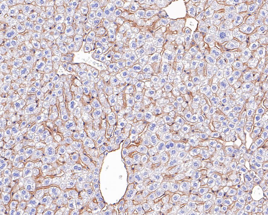 Immunohistochemical analysis of paraffin-embedded mouse kidney tissue with Rabbit anti-Pan-Cadherin antibody (ET1609-70) at 1/1,000 dilution.<br />
<br />
The section was pre-treated using heat mediated antigen retrieval with Tris-EDTA buffer (pH 9.0) for 20 minutes. The tissues were blocked in 1% BSA for 20 minutes at room temperature, washed with ddH2O and PBS, and then probed with the primary antibody (ET1609-70) at 1/1,000 dilution for 1 hour at room temperature. The detection was performed using an HRP conjugated compact polymer system. DAB was used as the chromogen. Tissues were counterstained with hematoxylin and mounted with DPX.