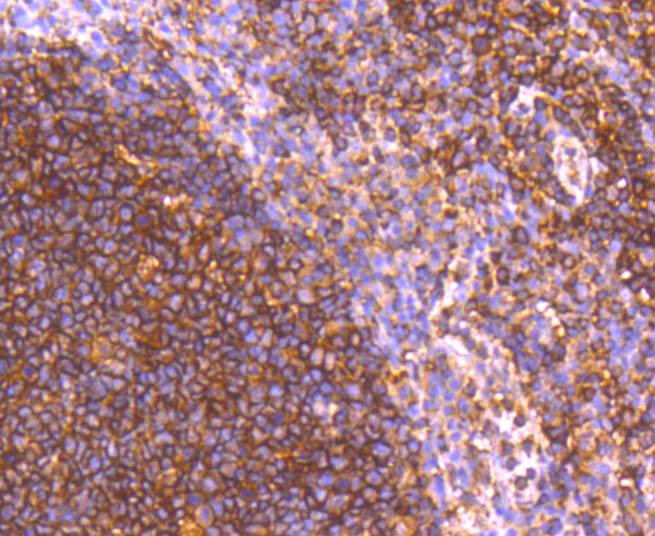 Immunohistochemical analysis of paraffin-embedded human tonsil tissue using anti-GRK2 antibody. The section was pre-treated using heat mediated antigen retrieval with Tris-EDTA buffer (pH 8.0-8.4) for 20 minutes.The tissues were blocked in 5% BSA for 30 minutes at room temperature, washed with ddH2O and PBS, and then probed with the primary antibody (ET1609-72, 1/50) for 30 minutes at room temperature. The detection was performed using an HRP conjugated compact polymer system. DAB was used as the chromogen. Tissues were counterstained with hematoxylin and mounted with DPX.