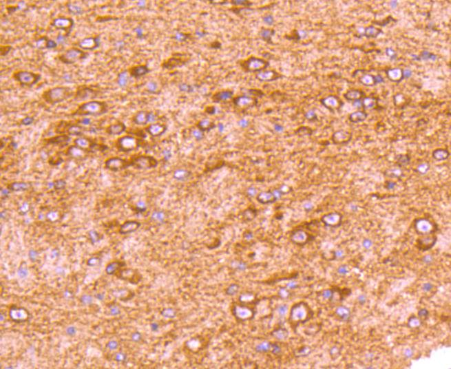 Immunohistochemical analysis of paraffin-embedded mouse brain tissue using anti-GRK2 antibody. The section was pre-treated using heat mediated antigen retrieval with Tris-EDTA buffer (pH 8.0-8.4) for 20 minutes.The tissues were blocked in 5% BSA for 30 minutes at room temperature, washed with ddH2O and PBS, and then probed with the primary antibody (ET1609-72, 1/50) for 30 minutes at room temperature. The detection was performed using an HRP conjugated compact polymer system. DAB was used as the chromogen. Tissues were counterstained with hematoxylin and mounted with DPX.