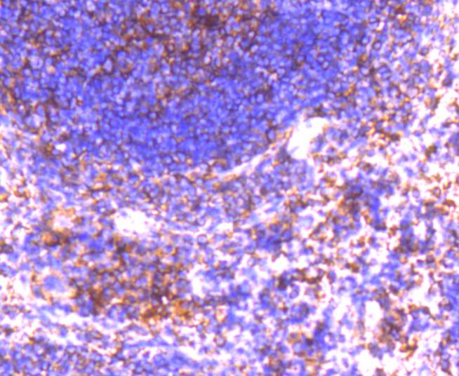 Immunohistochemical analysis of paraffin-embedded mouse spleen tissue using anti-GRK2 antibody. The section was pre-treated using heat mediated antigen retrieval with Tris-EDTA buffer (pH 8.0-8.4) for 20 minutes.The tissues were blocked in 5% BSA for 30 minutes at room temperature, washed with ddH2O and PBS, and then probed with the primary antibody (ET1609-72, 1/50) for 30 minutes at room temperature. The detection was performed using an HRP conjugated compact polymer system. DAB was used as the chromogen. Tissues were counterstained with hematoxylin and mounted with DPX.