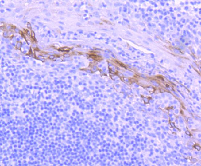 Immunohistochemical analysis of paraffin-embedded mouse skin tissue using anti-Cytokeratin 10 antibody. The section was pre-treated using heat mediated antigen retrieval with Tris-EDTA buffer (pH 8.0-8.4) for 20 minutes.The tissues were blocked in 5% BSA for 30 minutes at room temperature, washed with ddH2O and PBS, and then probed with the primary antibody (ET1609-75, 1/50) for 30 minutes at room temperature. The detection was performed using an HRP conjugated compact polymer system. DAB was used as the chromogen. Tissues were counterstained with hematoxylin and mounted with DPX.