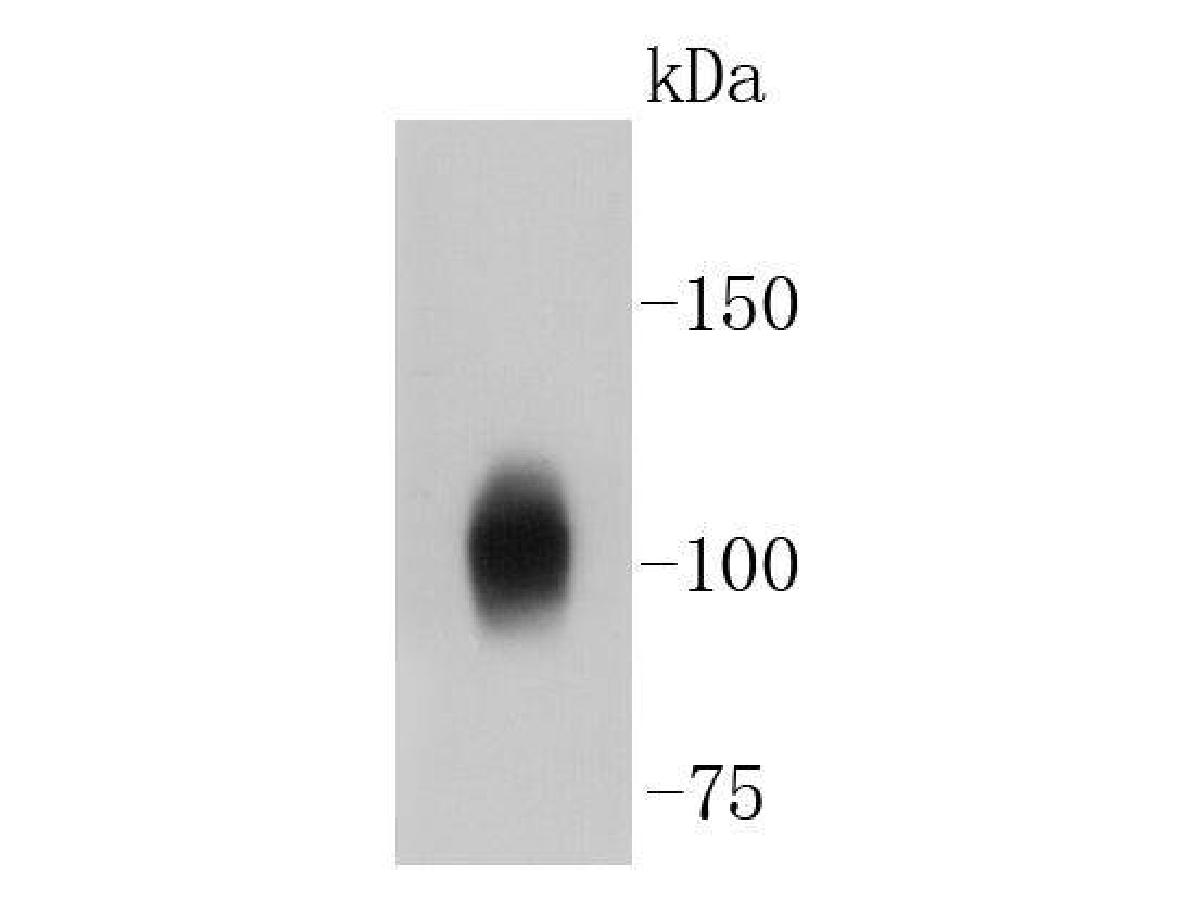 Western blot analysis of Sodium Potassium ATPase on different lysates with Rabbit anti-Sodium Potassium ATPase antibody (ET1609-76) at 1/500 dilution.<br />
<br />
Lane 1: Hela-si-NT cell lysate<br />
Lane 2: Hela-si-Sodium Potassium ATPase cell lysate<br />
<br />
Lysates/proteins at 10 µg/Lane.<br />
<br />
Predicted band size: 113 kDa<br />
Observed band size: 100 kDa<br />
<br />
Exposure time: 15 seconds;<br />
<br />
4-20% SDS-PAGE gel.<br />
<br />
ET1609-76 was shown to specifically react with Sodium Potassium ATPase in Hela-si-NT cells. Weakened band was observed when Hela-si-Sodium Potassium ATPase sample was tested. Hela-si-NT and Hela-si-Sodium Potassium ATPase samples were subjected to SDS-PAGE. Proteins were transferred to a PVDF membrane and blocked with 5% NFDM in TBST for 1 hour at room temperature. The primary antibody (ET1609-76, 1/500) and Loading control antibody (Rabbit anti-GAPDH , ET1601-4, 1/10,000) were used in 5% BSA at room temperature for 2 hours. Goat Anti-rabbit IgG-HRP Secondary Antibody (HA1001) at 1:300,000 dilution was used for 1 hour at room temperature.