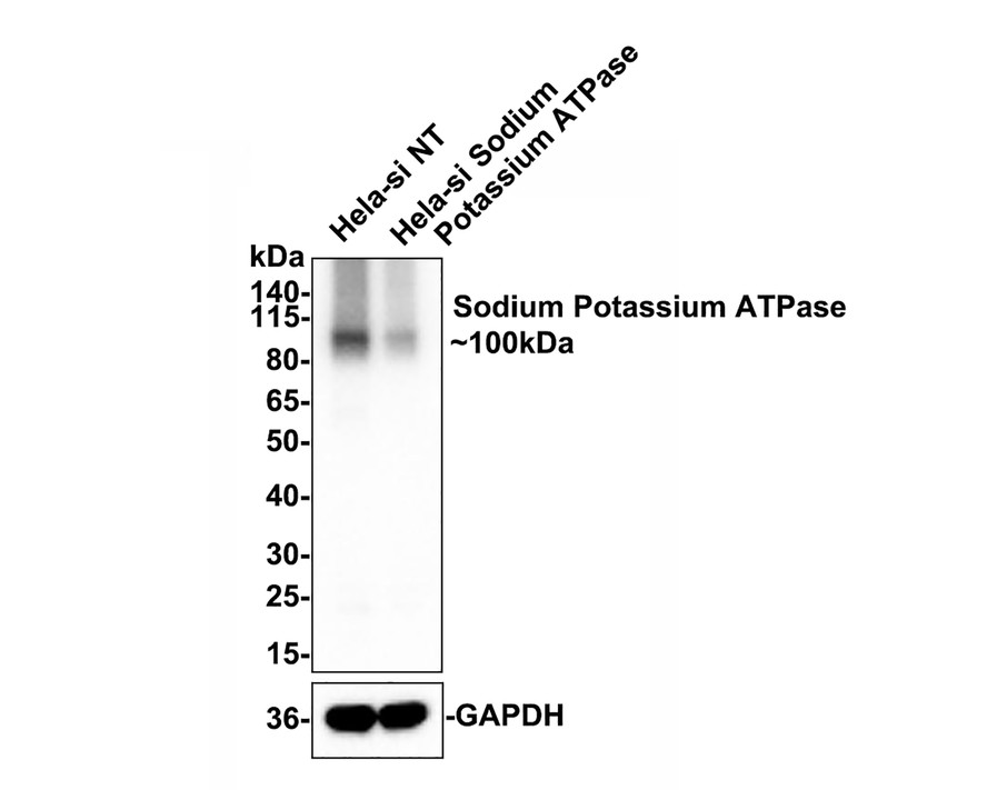 Western blot analysis of Sodium Potassium ATPase on different lysates with Rabbit anti-Sodium Potassium ATPase antibody (ET1609-76) at 1/500 dilution.<br />
<br />
Lane 1: Hela-si NT cell lysate<br />
Lane 2: Hela-si Sodium Potassium ATPase cell lysate<br />
<br />
Lysates/proteins at 10 µg/Lane.<br />
<br />
Predicted band size: 113 kDa<br />
Observed band size: 100 kDa<br />
<br />
Exposure time: 15 seconds;<br />
<br />
4-20% SDS-PAGE gel.<br />
<br />
ET1609-76 was shown to specifically react with Sodium Potassium ATPase in Hela-si NT cells. Weakened band was observed when Hela-si Sodium Potassium ATPase sample was tested. Hela-si NT and Hela-si Sodium Potassium ATPase samples were subjected to SDS-PAGE. Proteins were transferred to a PVDF membrane and blocked with 5% NFDM in TBST for 1 hour at room temperature. The primary antibody (ET1609-76, 1/500) and Loading control antibody (Rabbit anti-GAPDH , ET1601-4, 1/10,000) were used in 5% BSA at room temperature for 2 hours. Goat Anti-rabbit IgG-HRP Secondary Antibody (HA1001) at 1:300,000 dilution was used for 1 hour at room temperature.