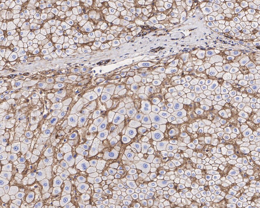 Immunohistochemical analysis of paraffin-embedded human liver tissue with Rabbit anti-Sodium Potassium ATPase antibody (ET1609-76) at 1/2,000 dilution.<br />
<br />
The section was pre-treated using heat mediated antigen retrieval with Tris-EDTA buffer (pH 9.0) for 20 minutes. The tissues were blocked in 1% BSA for 20 minutes at room temperature, washed with ddH2O and PBS, and then probed with the primary antibody (ET1609-76) at 1/2,000 dilution for 1 hour at room temperature. The detection was performed using an HRP conjugated compact polymer system. DAB was used as the chromogen. Tissues were counterstained with hematoxylin and mounted with DPX.