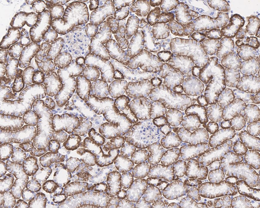 Immunohistochemical analysis of paraffin-embedded rat kidney tissue with Rabbit anti-Sodium Potassium ATPase antibody (ET1609-76) at 1/500 dilution.<br />
<br />
The section was pre-treated using heat mediated antigen retrieval with Tris-EDTA buffer (pH 9.0) for 20 minutes. The tissues were blocked in 1% BSA for 20 minutes at room temperature, washed with ddH2O and PBS, and then probed with the primary antibody (ET1609-76) at 1/500 dilution for 1 hour at room temperature. The detection was performed using an HRP conjugated compact polymer system. DAB was used as the chromogen. Tissues were counterstained with hematoxylin and mounted with DPX.