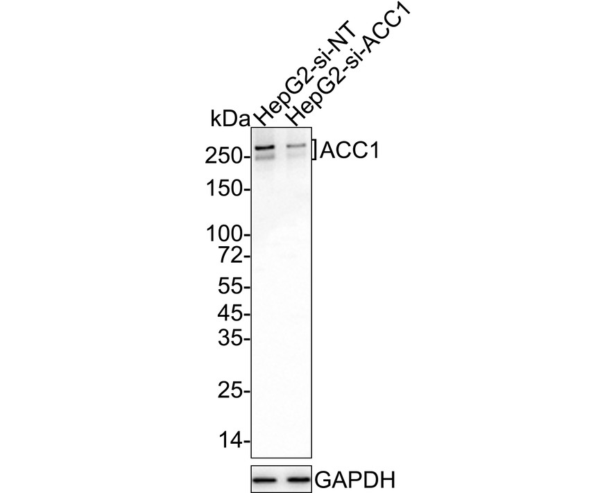 Immunohistochemical analysis of paraffin-embedded human kidney tissue with Rabbit anti-Acetyl CoA Carboxylase 1(ACC1) antibody (ET1609-77) at 1/100 dilution.<br />
<br />
The section was pre-treated using heat mediated antigen retrieval with Tris-EDTA buffer (pH 9.0) for 20 minutes. The tissues were blocked in 1% BSA for 20 minutes at room temperature, washed with ddH2O and PBS, and then probed with the primary antibody (ET1609-77) at 1/100 dilution for 1 hour at room temperature. The detection was performed using an HRP conjugated compact polymer system. DAB was used as the chromogen. Tissues were counterstained with hematoxylin and mounted with DPX.