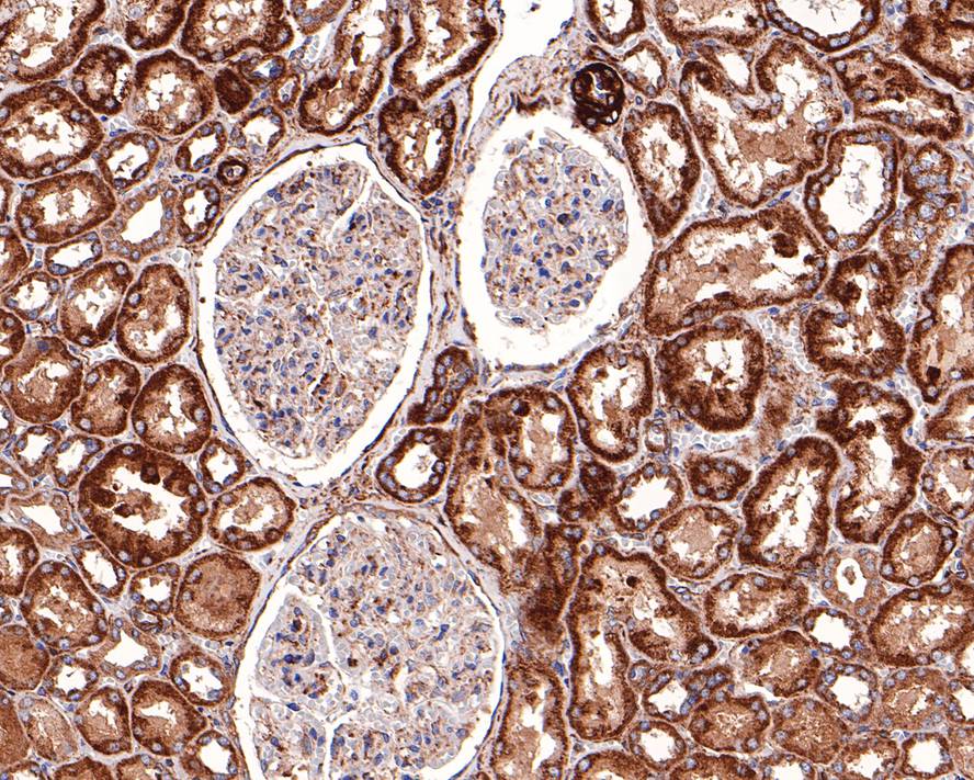 Immunohistochemical analysis of paraffin-embedded mouse placenta tissue using anti-Acetyl CoA Carboxylase 1(ACC1) antibody. The section was pre-treated using heat mediated antigen retrieval with Tris-EDTA buffer (pH 8.0-8.4) for 20 minutes.The tissues were blocked in 5% BSA for 30 minutes at room temperature, washed with ddH2O and PBS, and then probed with the primary antibody (ET1609-77, 1/50) for 30 minutes at room temperature. The detection was performed using an HRP conjugated compact polymer system. DAB was used as the chromogen. Tissues were counterstained with hematoxylin and mounted with DPX.