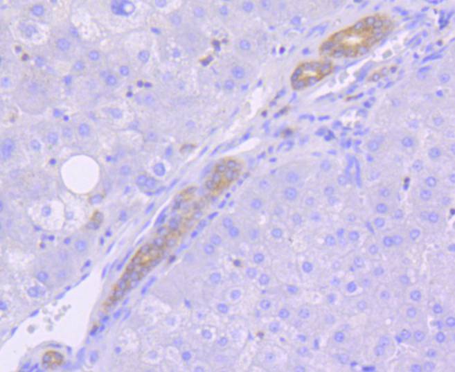 Immunohistochemical analysis of paraffin-embedded human pancreas tissue with Rabbit anti-MSI2 antibody (ET1609-79) at 1/50 dilution.<br />
<br />
The section was pre-treated using heat mediated antigen retrieval with Tris-EDTA buffer (pH 8.0-8.4) for 20 minutes. The tissues were blocked in 1% BSA for 20 minutes at room temperature, washed with ddH2O and PBS, and then probed with the primary antibody (ET1609-79) at 1/50 dilution for 0.5 hour at room temperature. The detection was performed using an HRP conjugated compact polymer system. DAB was used as the chromogen. Tissues were counterstained with hematoxylin and mounted with DPX.