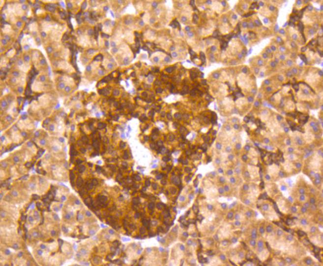 Immunohistochemical analysis of paraffin-embedded mouse liver tissue with Rabbit anti-MSI2 antibody (ET1609-79) at 1/50 dilution.<br />
<br />
The section was pre-treated using heat mediated antigen retrieval with Tris-EDTA buffer (pH 8.0-8.4) for 20 minutes. The tissues were blocked in 1% BSA for 20 minutes at room temperature, washed with ddH2O and PBS, and then probed with the primary antibody (ET1609-79) at 1/50 dilution for 0.5 hour at room temperature. The detection was performed using an HRP conjugated compact polymer system. DAB was used as the chromogen. Tissues were counterstained with hematoxylin and mounted with DPX.