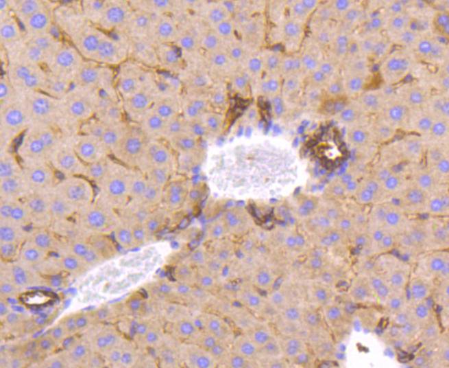 Immunohistochemical analysis of paraffin-embedded mouse prostate tissue with Rabbit anti-MSI2 antibody (ET1609-79) at 1/50 dilution.<br />
<br />
The section was pre-treated using heat mediated antigen retrieval with Tris-EDTA buffer (pH 8.0-8.4) for 20 minutes. The tissues were blocked in 1% BSA for 20 minutes at room temperature, washed with ddH2O and PBS, and then probed with the primary antibody (ET1609-79) at 1/50 dilution for 0.5 hour at room temperature. The detection was performed using an HRP conjugated compact polymer system. DAB was used as the chromogen. Tissues were counterstained with hematoxylin and mounted with DPX.
