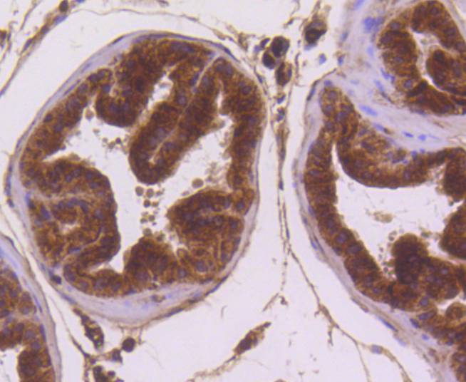 Immunohistochemical analysis of paraffin-embedded mouse heart tissue with Rabbit anti-MSI2 antibody (ET1609-79) at 1/50 dilution.<br />
<br />
The section was pre-treated using heat mediated antigen retrieval with Tris-EDTA buffer (pH 8.0-8.4) for 20 minutes. The tissues were blocked in 1% BSA for 20 minutes at room temperature, washed with ddH2O and PBS, and then probed with the primary antibody (ET1609-79) at 1/50 dilution for 0.5 hour at room temperature. The detection was performed using an HRP conjugated compact polymer system. DAB was used as the chromogen. Tissues were counterstained with hematoxylin and mounted with DPX.