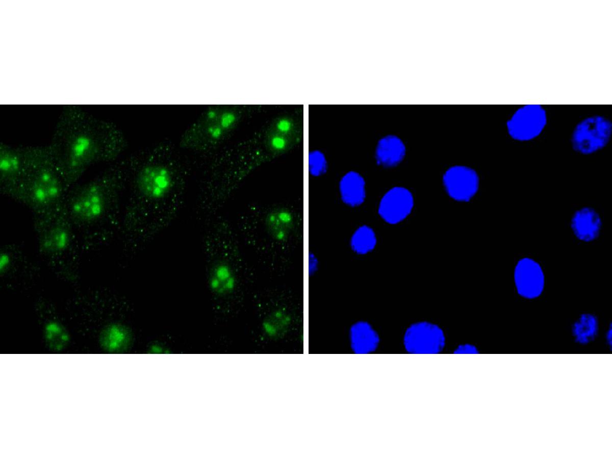 ICC staining Histone H3(mono methyl R2) in NIH/3T3 cells (green). The nuclear counter stain is DAPI (blue). Cells were fixed in paraformaldehyde, permeabilised with 0.25% Triton X100/PBS.