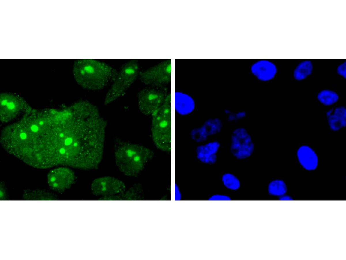 ICC staining Histone H3(mono methyl R2) in PC-3M cells (green). The nuclear counter stain is DAPI (blue). Cells were fixed in paraformaldehyde, permeabilised with 0.25% Triton X100/PBS.