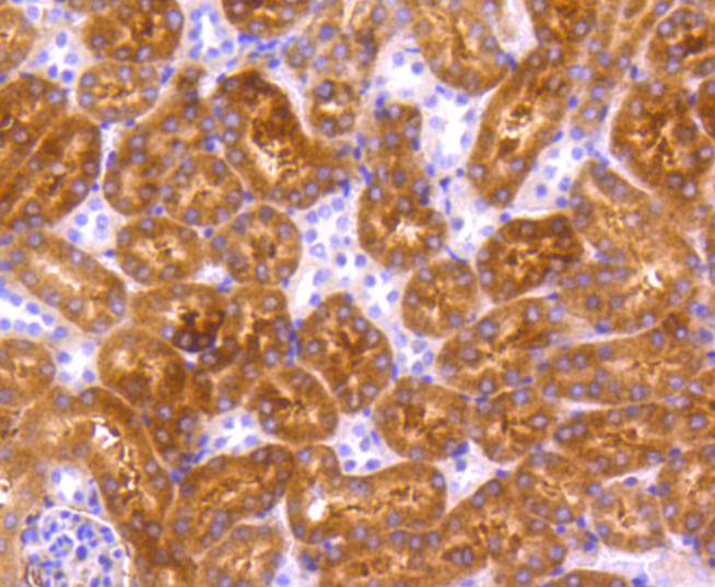 Immunohistochemical analysis of paraffin-embedded mouse kidney tissue using anti-p73 antibody. The section was pre-treated using heat mediated antigen retrieval with Tris-EDTA buffer (pH 8.0-8.4) for 20 minutes.The tissues were blocked in 5% BSA for 30 minutes at room temperature, washed with ddH2O and PBS, and then probed with the primary antibody (ET1609-80, 1/50) for 30 minutes at room temperature. The detection was performed using an HRP conjugated compact polymer system. DAB was used as the chromogen. Tissues were counterstained with hematoxylin and mounted with DPX.