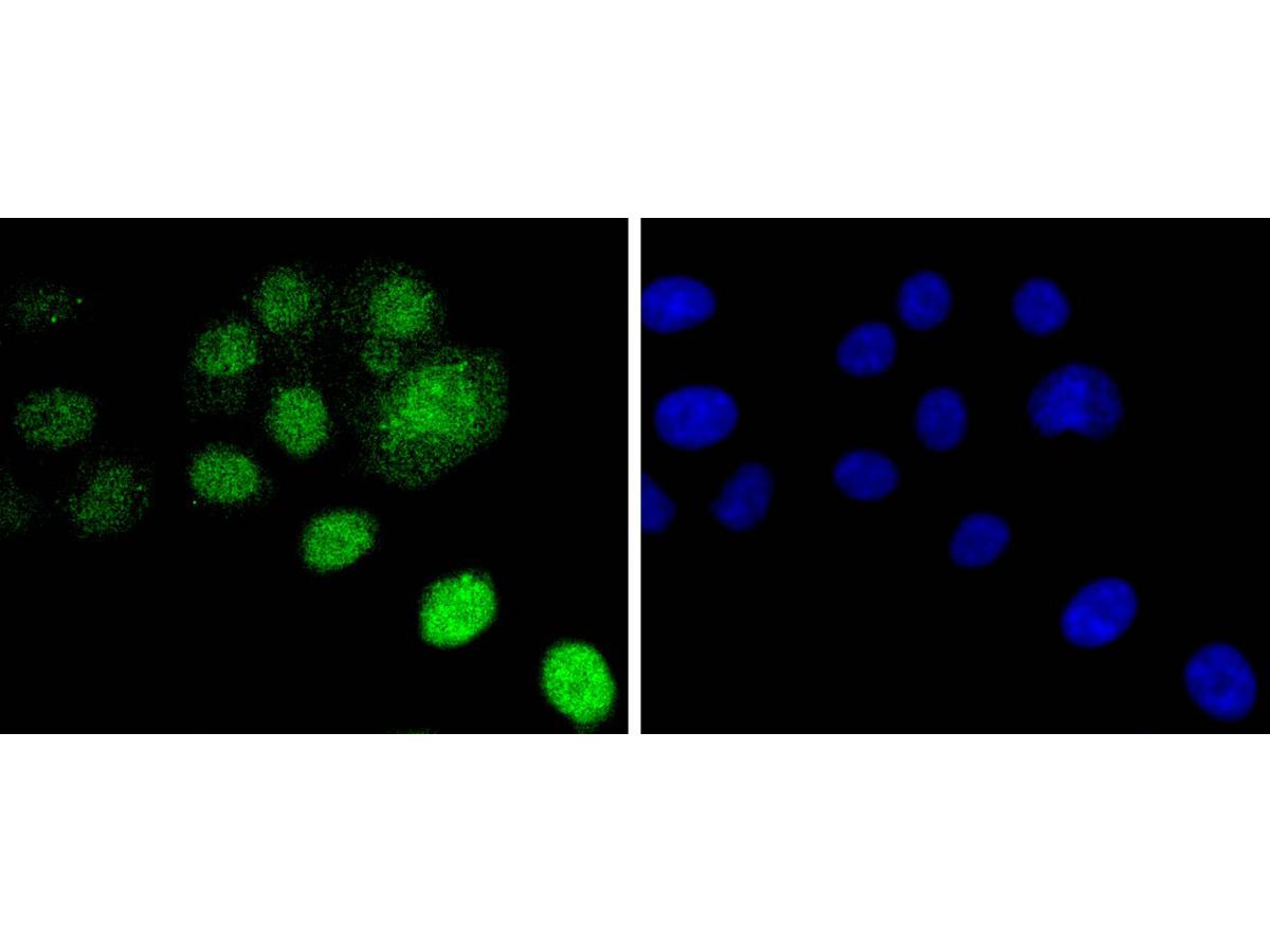 ICC staining Histone H2B(mono methyl R79) in HepG2 cells (green). The nuclear counter stain is DAPI (blue). Cells were fixed in paraformaldehyde, permeabilised with 0.25% Triton X100/PBS.