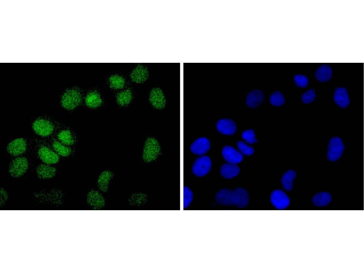 ICC staining Histone H2B(mono methyl R79) in Hela cells (green). The nuclear counter stain is DAPI (blue). Cells were fixed in paraformaldehyde, permeabilised with 0.25% Triton X100/PBS.